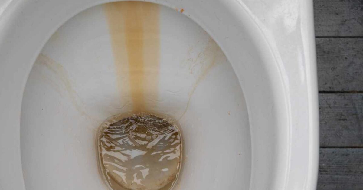 Does your toilet also have these stains?  I'll tell you how I solved it, now it shines